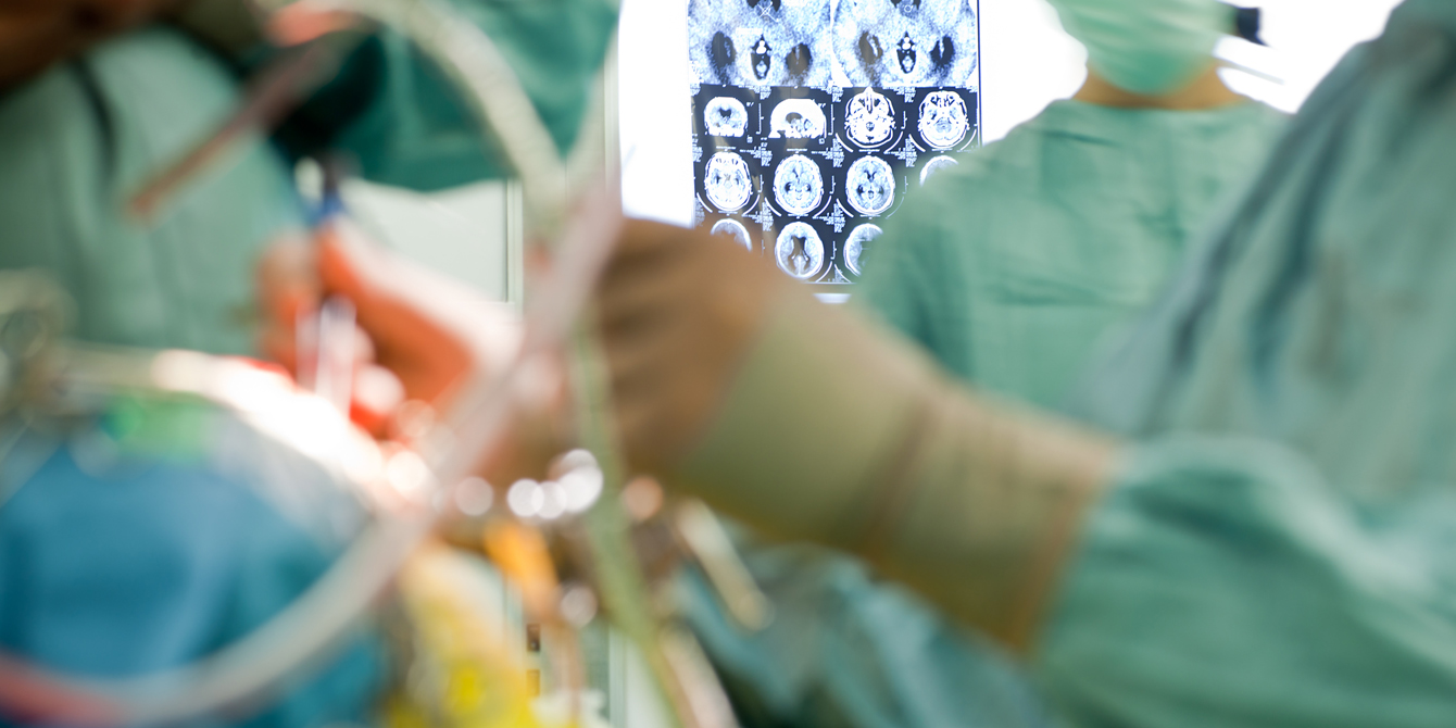 Blurred figures of surgeons performing brain surgery, with a focus on brain imaging in the background.